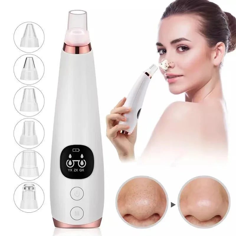Removedor de Cravos Elétrico a Vácuo – Limpeza Profunda da Pele, Acne e Poros